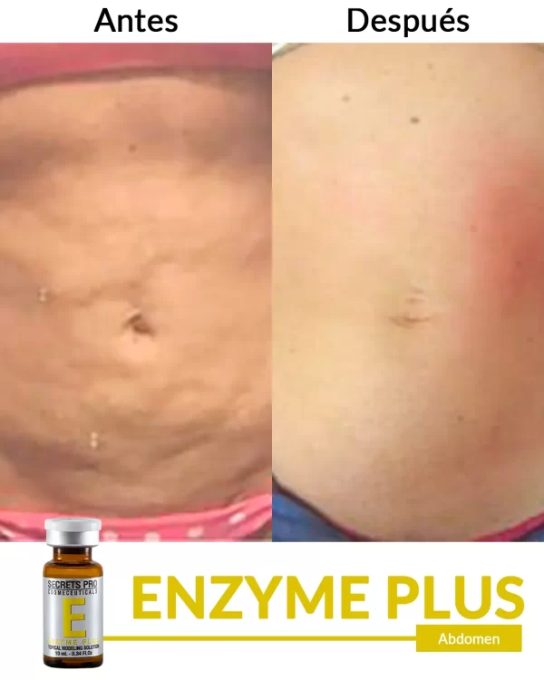 Enzyme Plus