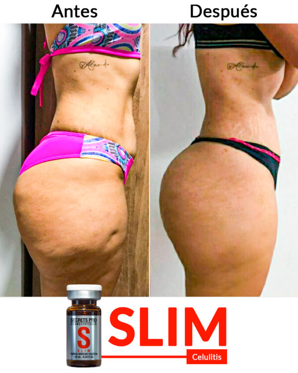 Celulitis-___ Slim