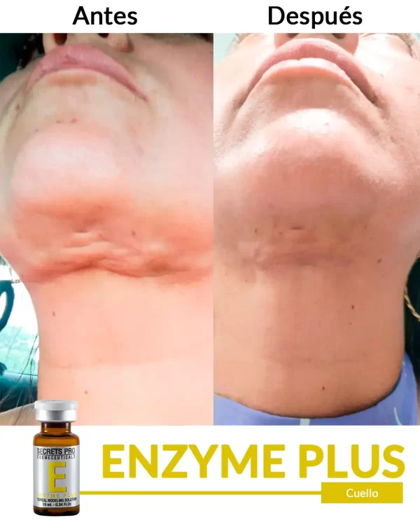 Enzyme Plus