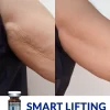 Smart Lifting