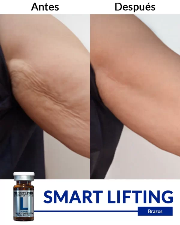 Smart Lifting