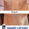 Smart Lifting
