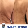 Smart Lifting